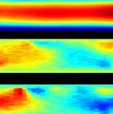 magnetic resonance